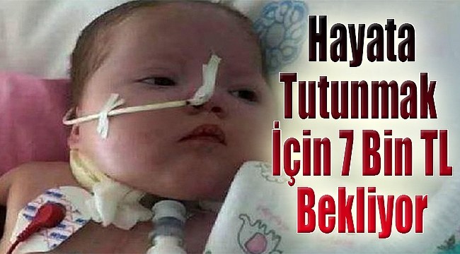 7 bin TL Firdevs bebeğin hayatını kurtaracak!