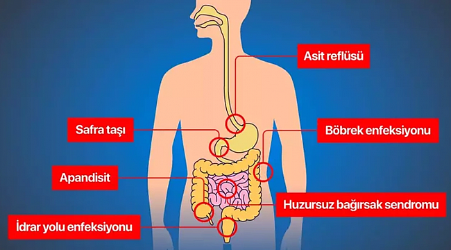 Karın ağrınızın yeri ne anlama geliyor?