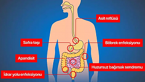 Karın ağrınızın yeri ne anlama geliyor?