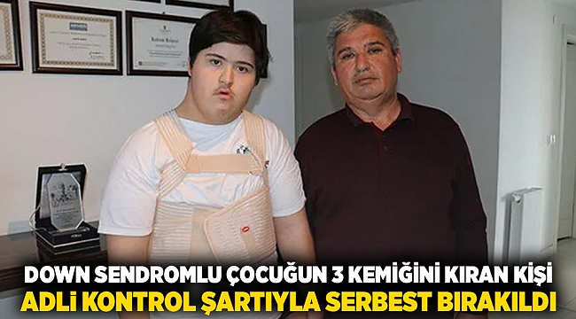 Down sendromlu çocuğun 3 kemiğini kıran kişi, adli kontrol şartıyla serbest bırakıldı