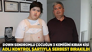 Down sendromlu çocuğun 3 kemiğini kıran kişi, adli kontrol şartıyla serbest bırakıldı