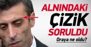 Musul Başkonsolosu Yılmaz'ın alnı çizilmiş